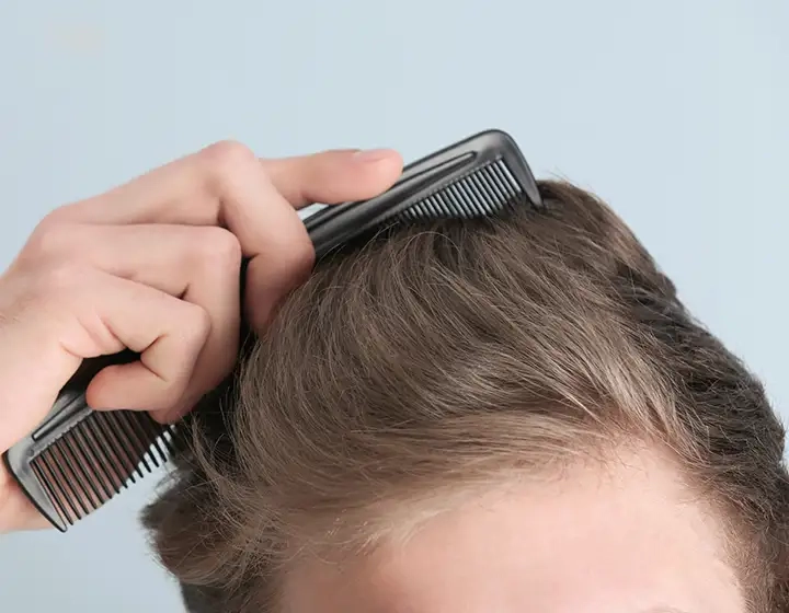 Mens Hair Loss Treatment Norfolk
