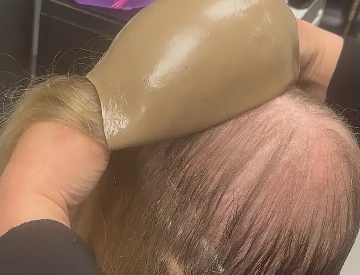 Signature Scalp Norfolk